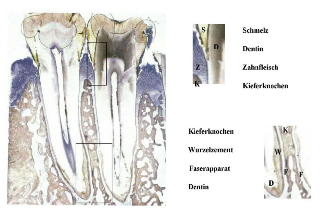 Parodont - Zahnarzt Martin Schaller in Plauen